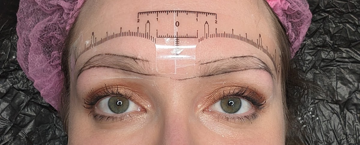 Bpermanent — laser tattoo removal clinic in Preston