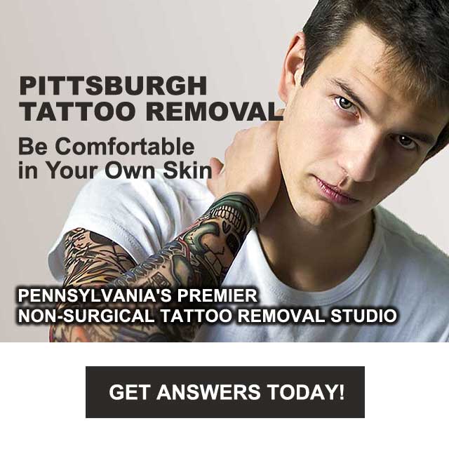 Noggin Master Studios โ laser tattoo removal clinic in Pittsburgh