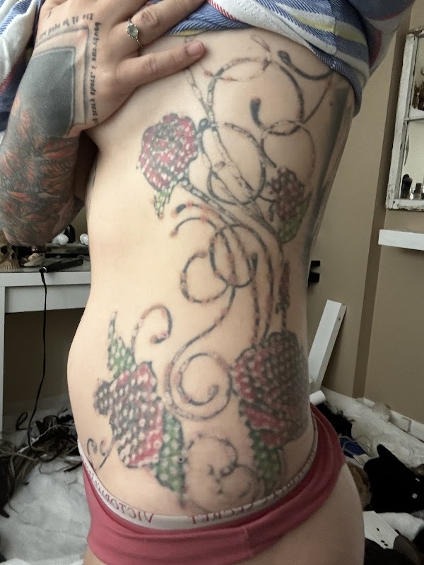 Rejuvatek Aesthetics providing inkOUT® — laser tattoo removal clinic in Chicago