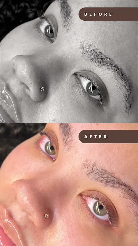 Tru Spa by Heba β laser tattoo removal clinic in Carmel