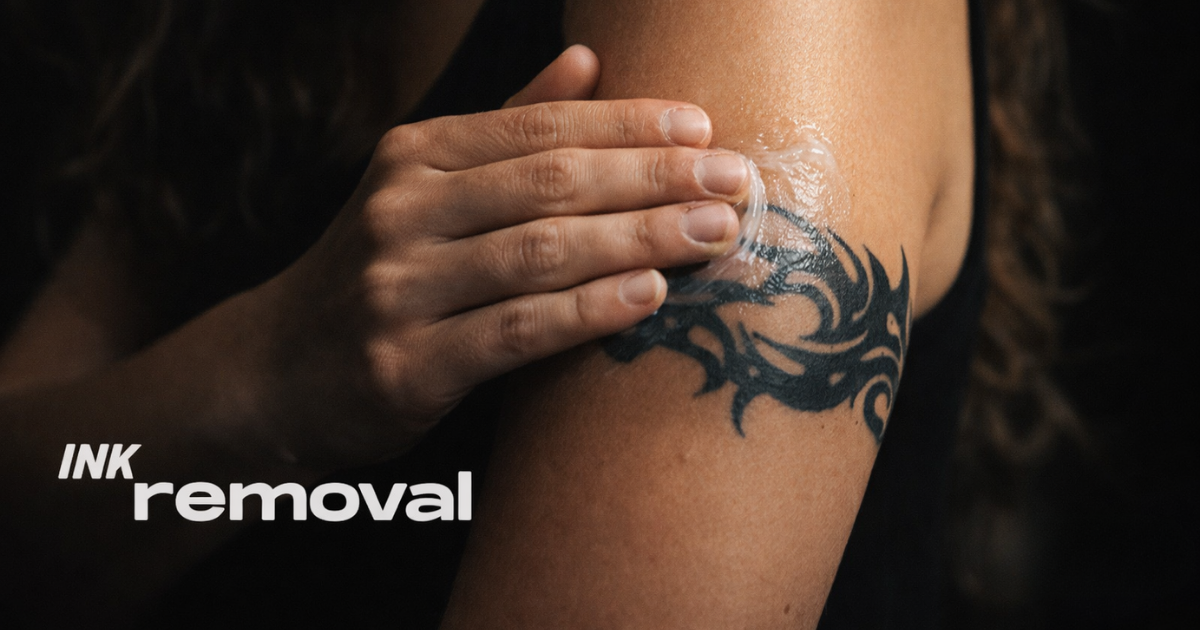 InkRemoval.com — laser tattoo removal clinic in Dallas