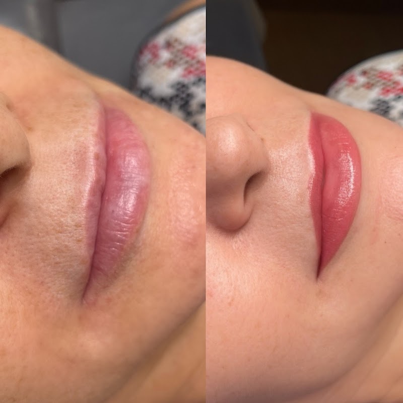Permanent Beauty by Irina — laser tattoo removal clinic in Winter Park