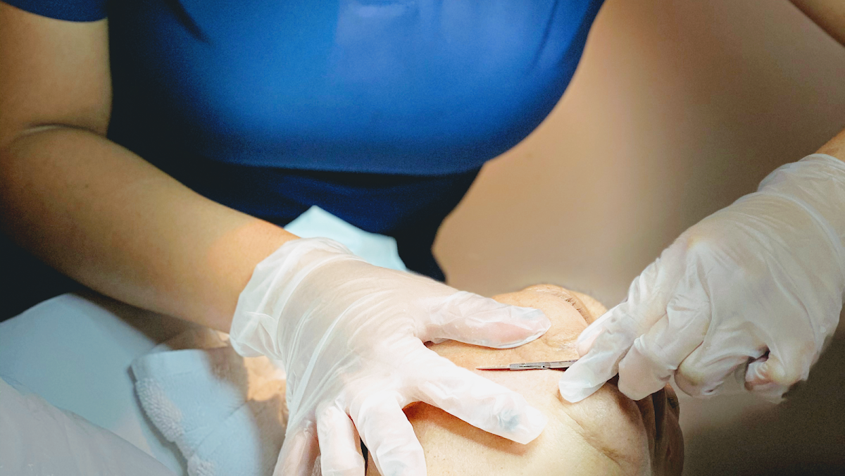Cosmetic Laser Center San Antonio — laser tattoo removal clinic in San Antonio