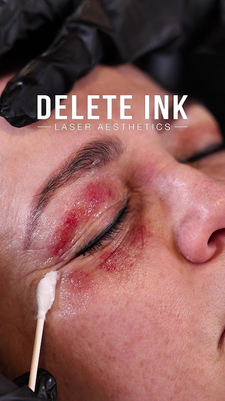 Delete Ink Laser Aesthetics — laser tattoo removal clinic in Tucson