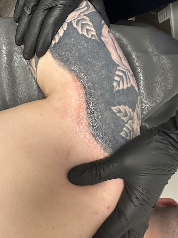 Atlas Beauty, Inc. β laser tattoo removal clinic in Williamsville