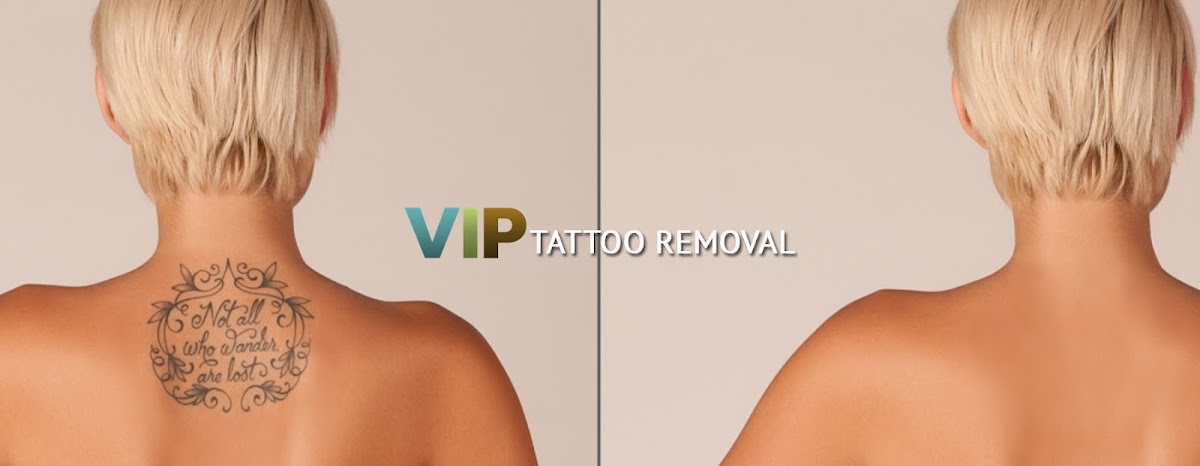 VIP Tattoo Removal - Las Vegas — laser tattoo removal clinic in Henderson