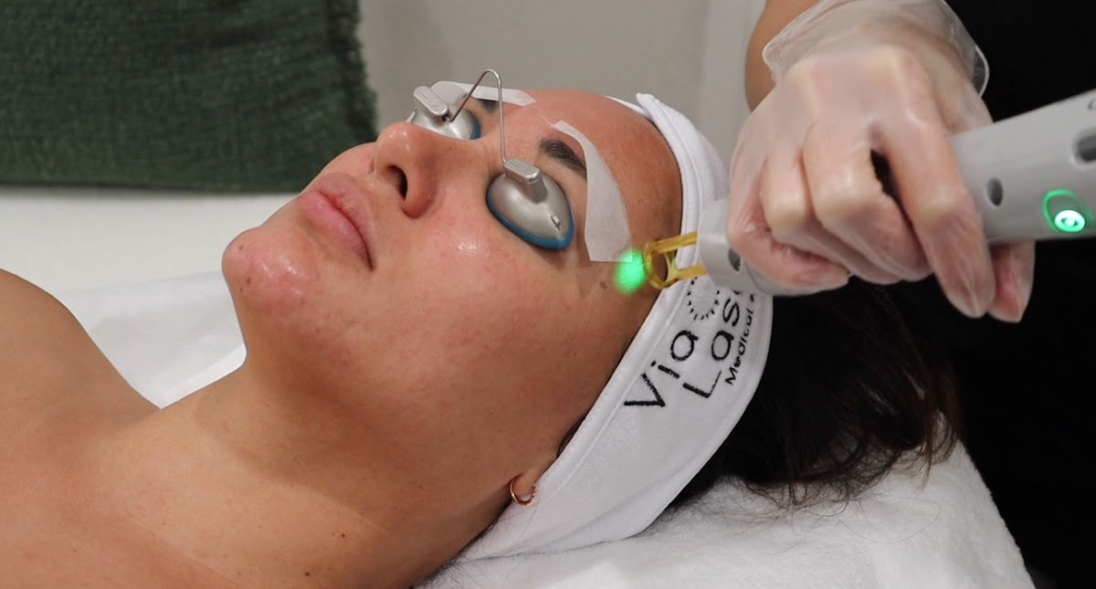 Via Laser β laser tattoo removal clinic in Las Vegas