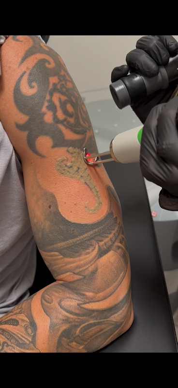 REVIVE Tattoo Removal & Skin Health β laser tattoo removal clinic in Bradenton