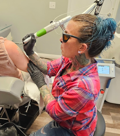 Oops! Laser — laser tattoo removal clinic in Tucson