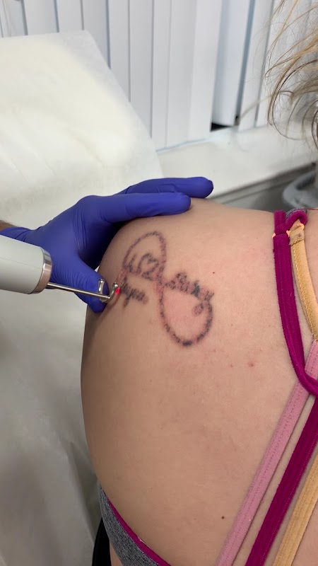 MD Laser Tattoo Removal — laser tattoo removal clinic in Glen Burnie