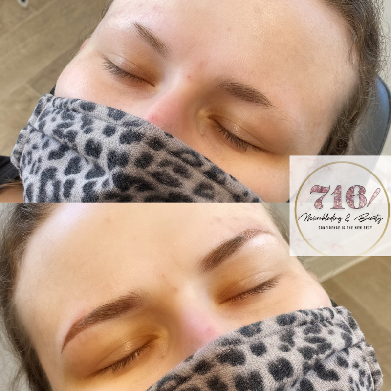 716 Microblading & Beauty β laser tattoo removal clinic in Tonawanda