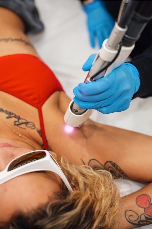 Erase Spa β laser tattoo removal clinic in New York