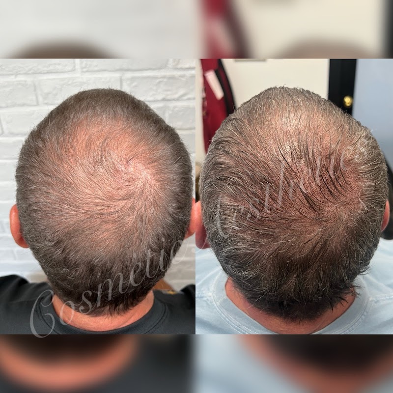 Cosmetic Aesthetics — laser tattoo removal clinic in Phoenix