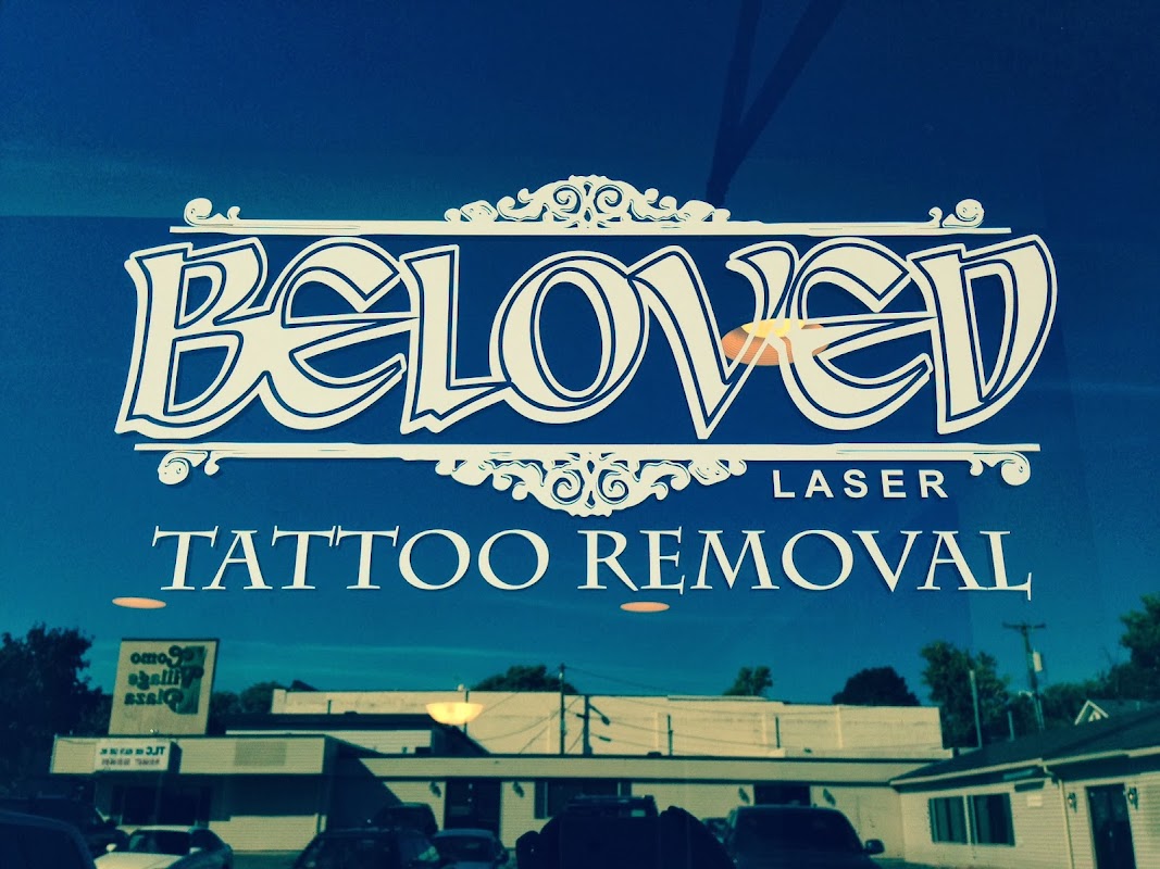 Beloved Laser Tattoo Removal โ laser tattoo removal clinic in Roseville