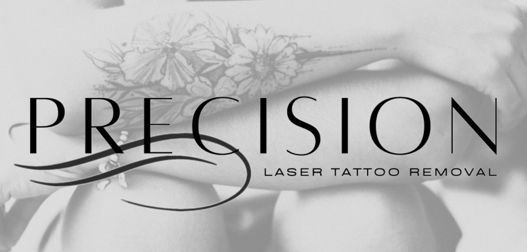 Precision Laser Tattoo Removal β laser tattoo removal clinic in Land O' Lakes