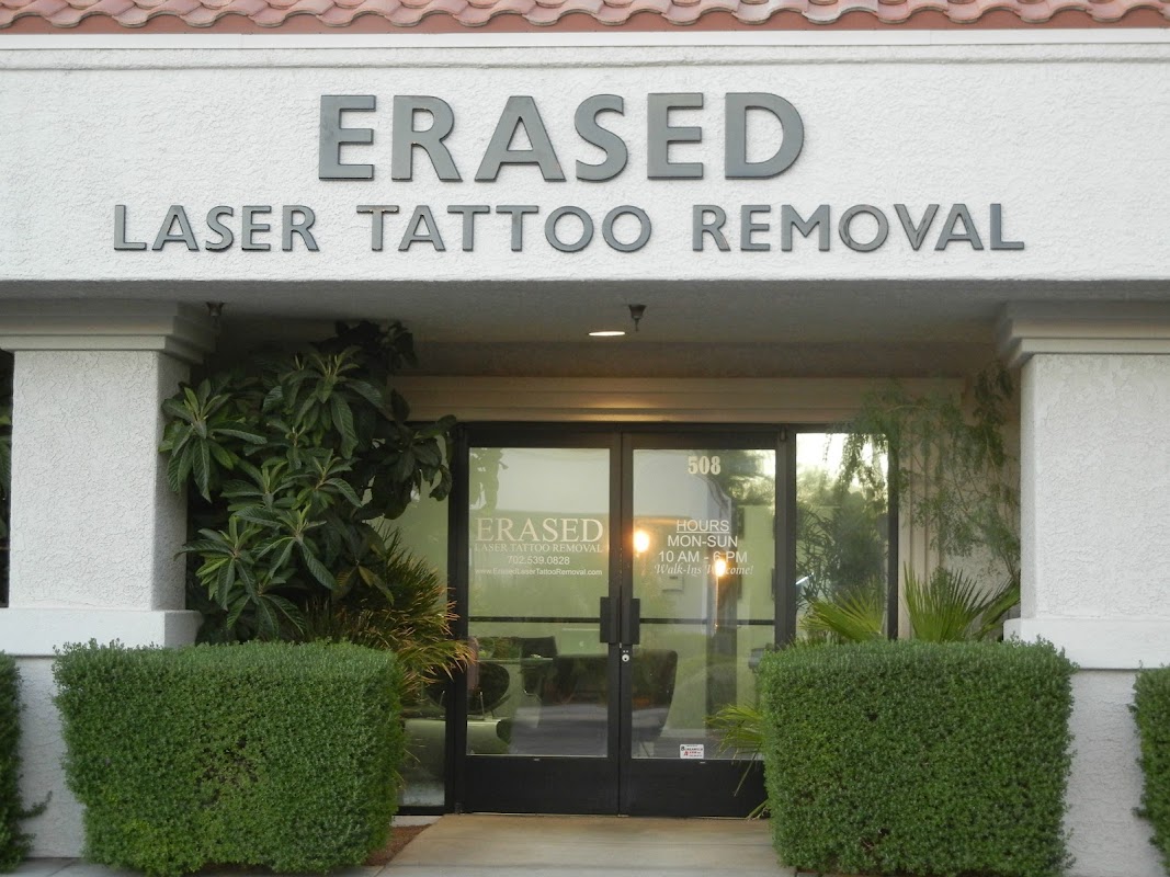 Erased Laser Tattoo Removal — laser tattoo removal clinic in Las Vegas