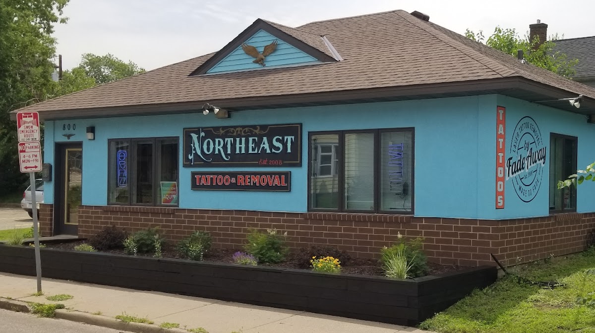 Northeast Tattoo & Fadeaway Laser Tattoo Removal โ laser tattoo removal clinic in Minneapolis