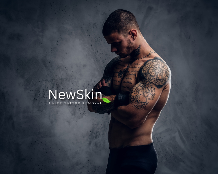 NewSkin Laser Tattoo Removal — laser tattoo removal clinic in San Antonio