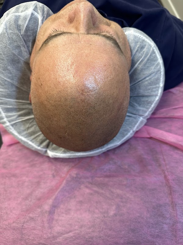 Flawless ink by Nina — laser tattoo removal clinic in La Mesa