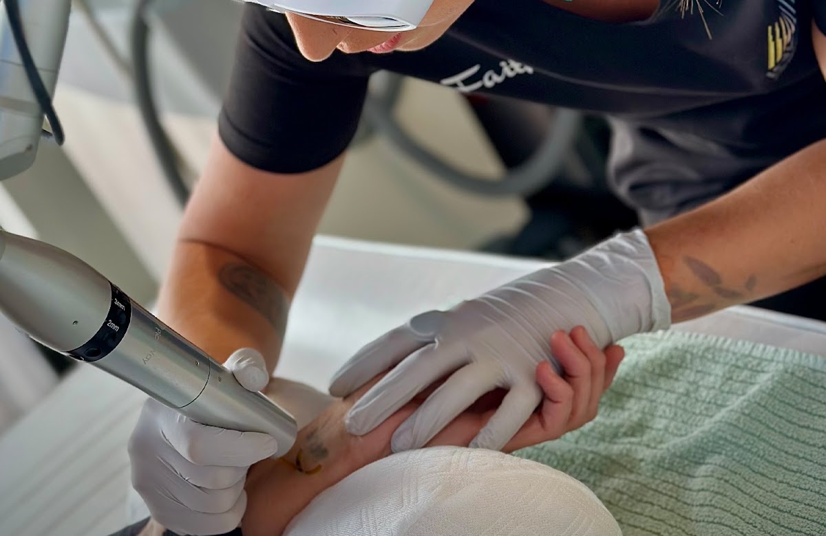 Inkless Tattoo Removal — laser tattoo removal clinic in Philadelphia