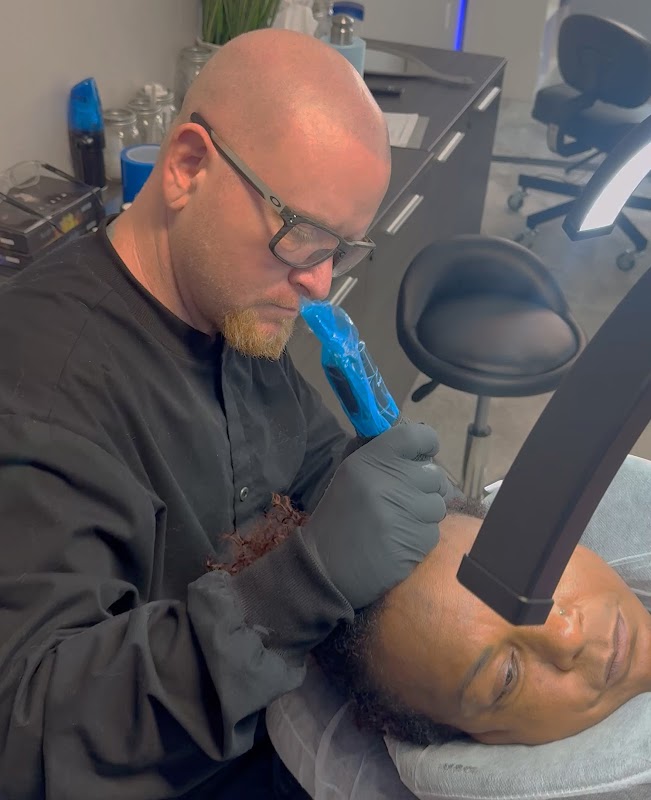 Ultra Scalp Micropigmentation — laser tattoo removal clinic in Tampa
