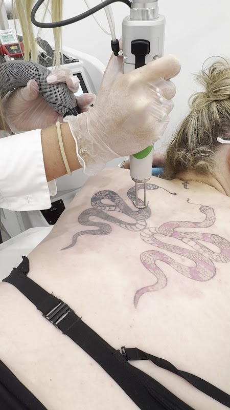 Think Again Tattoo Removal - Costa Mesa — laser tattoo removal clinic in Costa Mesa