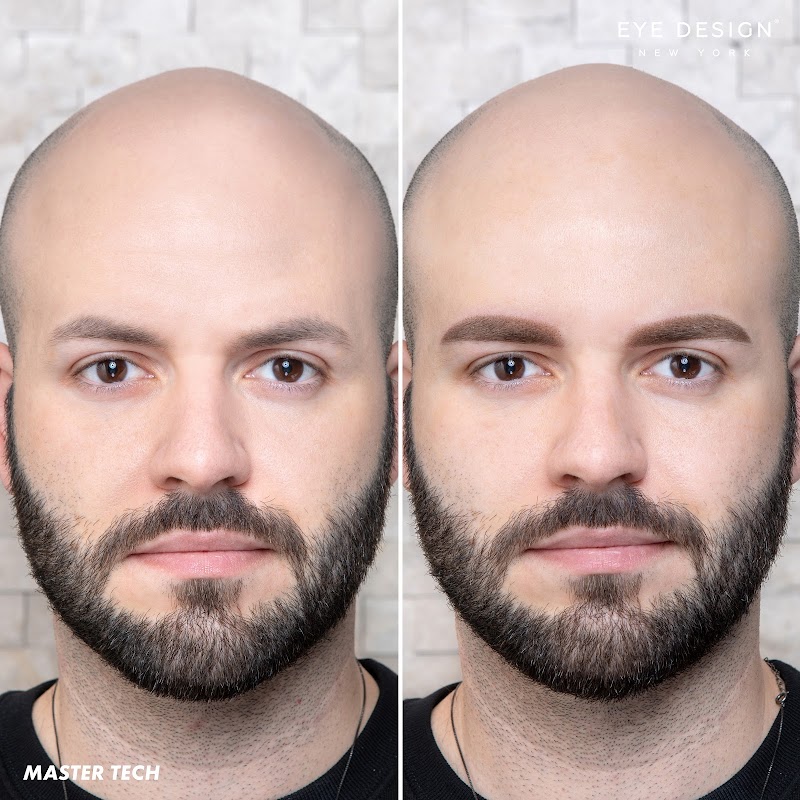 Eye Design New York — laser tattoo removal clinic in New York