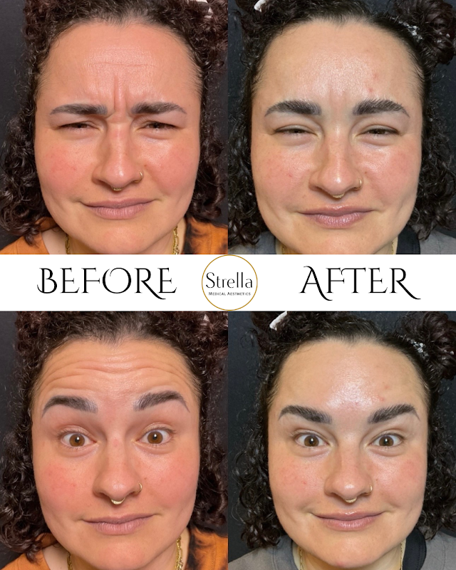 Strella Medical Aesthetics — laser tattoo removal clinic in Trooper