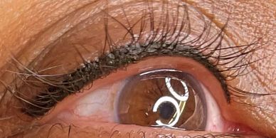 Artizen Ink — laser tattoo removal clinic in San Jose