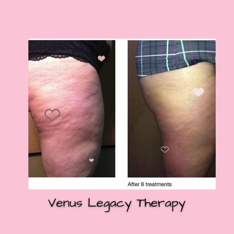Tropical Sunset Laser & Esthetics — laser tattoo removal clinic in Fort Myers