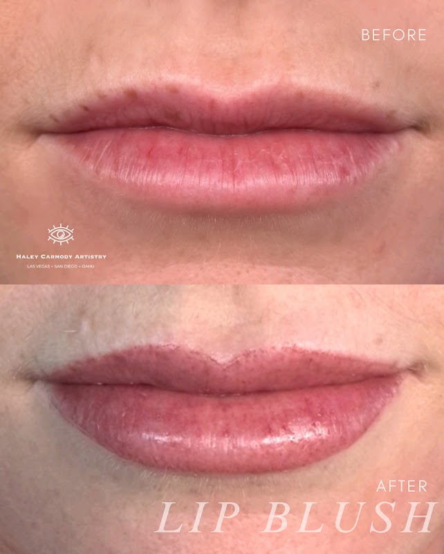 Haley Carmody Artistry β laser tattoo removal clinic in La Jolla