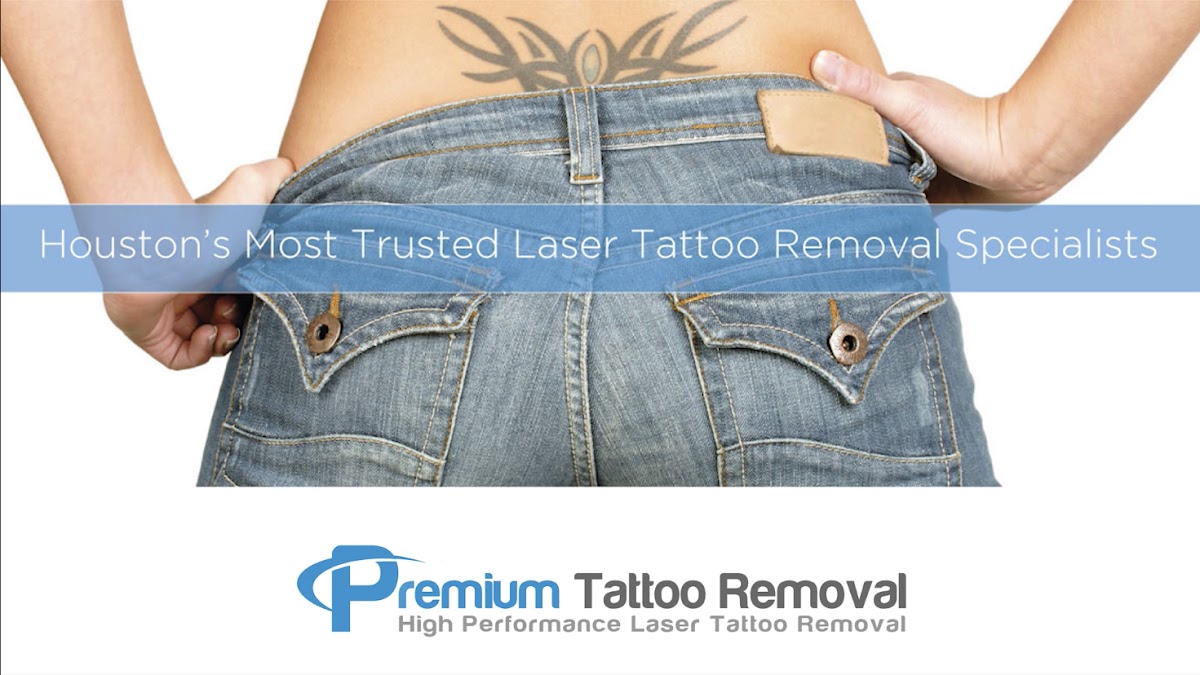 Premium Tattoo Removal — laser tattoo removal clinic in Houston