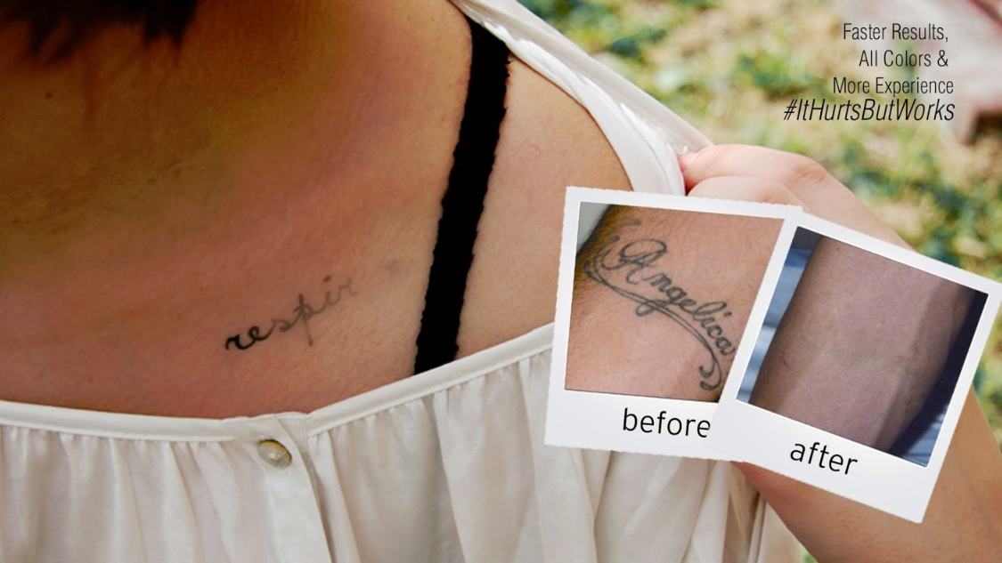 EradiTatt Tattoo Removal of St. Petersburg — laser tattoo removal clinic in St. Petersburg
