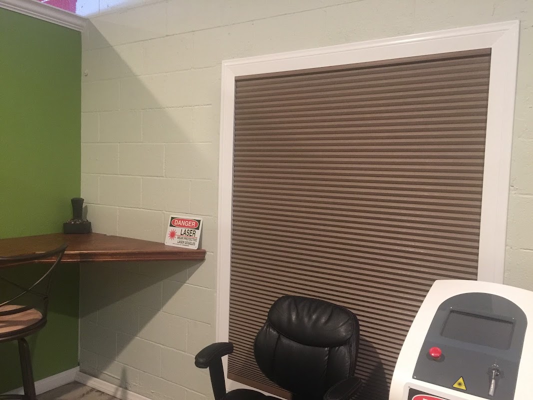 Oxnard Tattoo Removals LLC — laser tattoo removal clinic in Oxnard