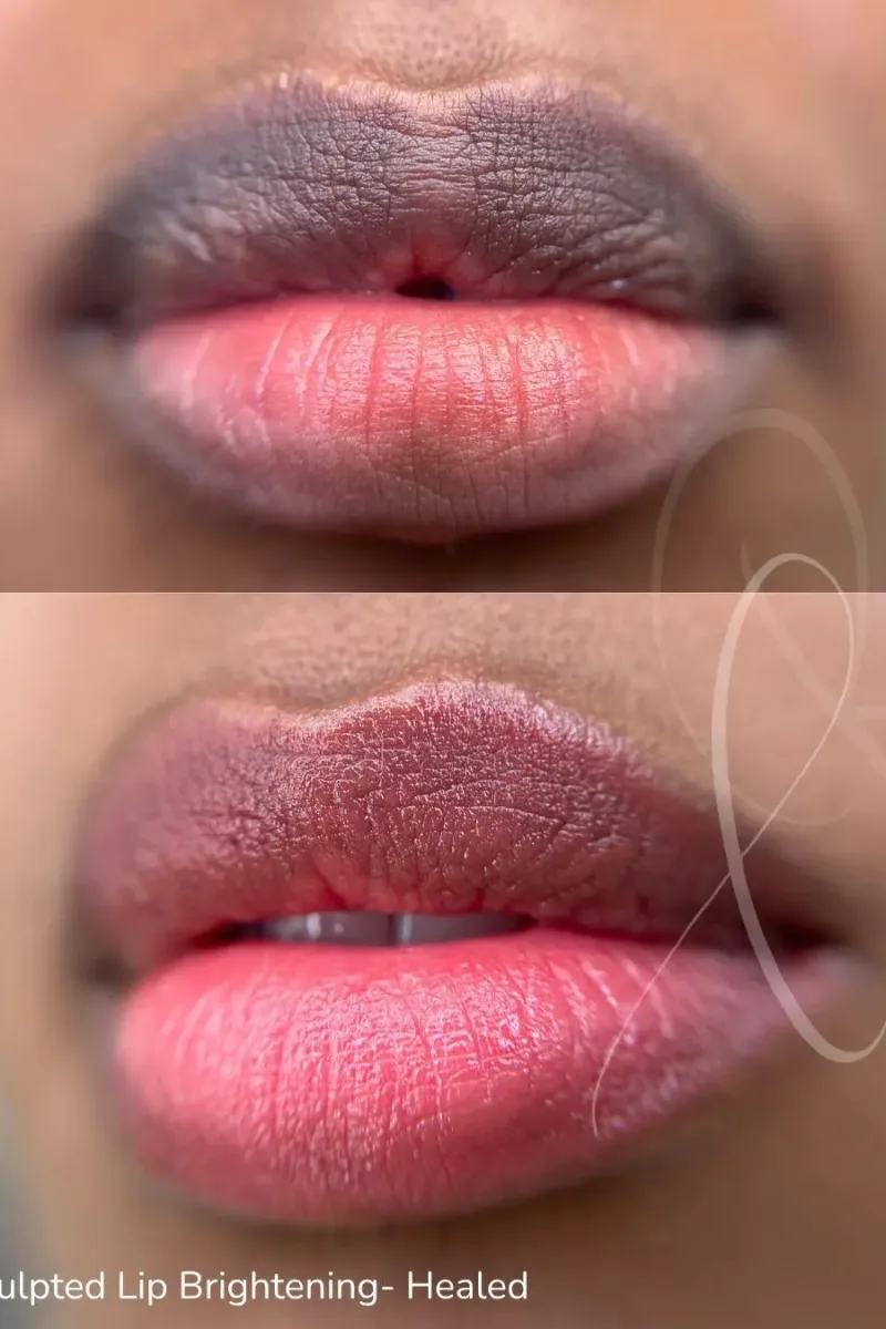 Sculpted Studios Miami — laser tattoo removal clinic in Miami