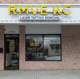 RMVE KC Laser Tattoo Removal β laser tattoo removal clinic in Gladstone