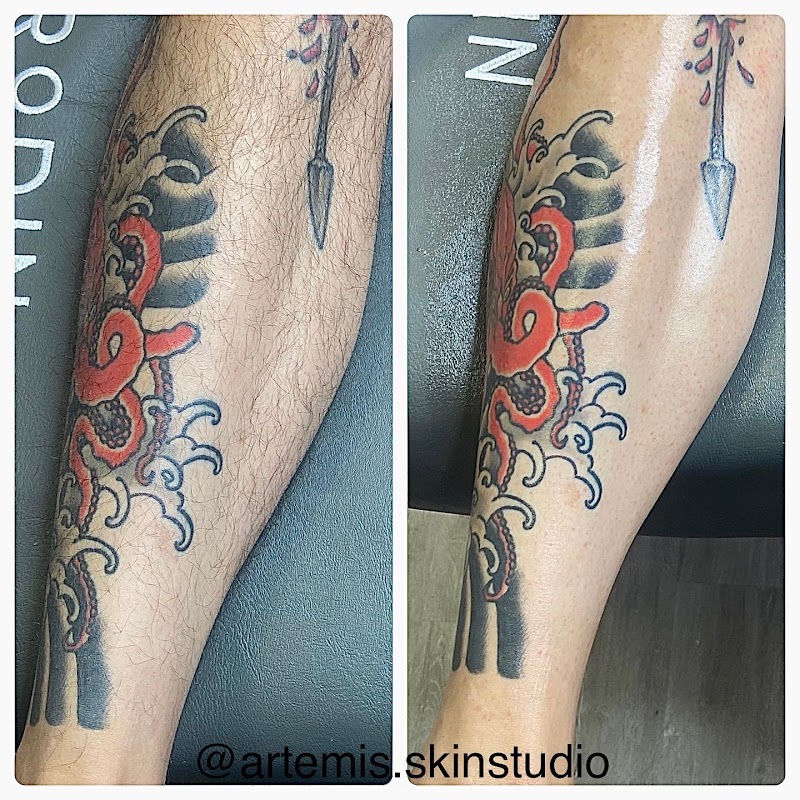 Artemis Skin Studio LLC — laser tattoo removal clinic in Colorado Springs