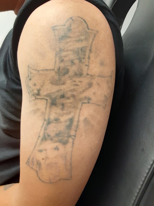 Fearless Tattoo Removal — laser tattoo removal clinic in Maplewood