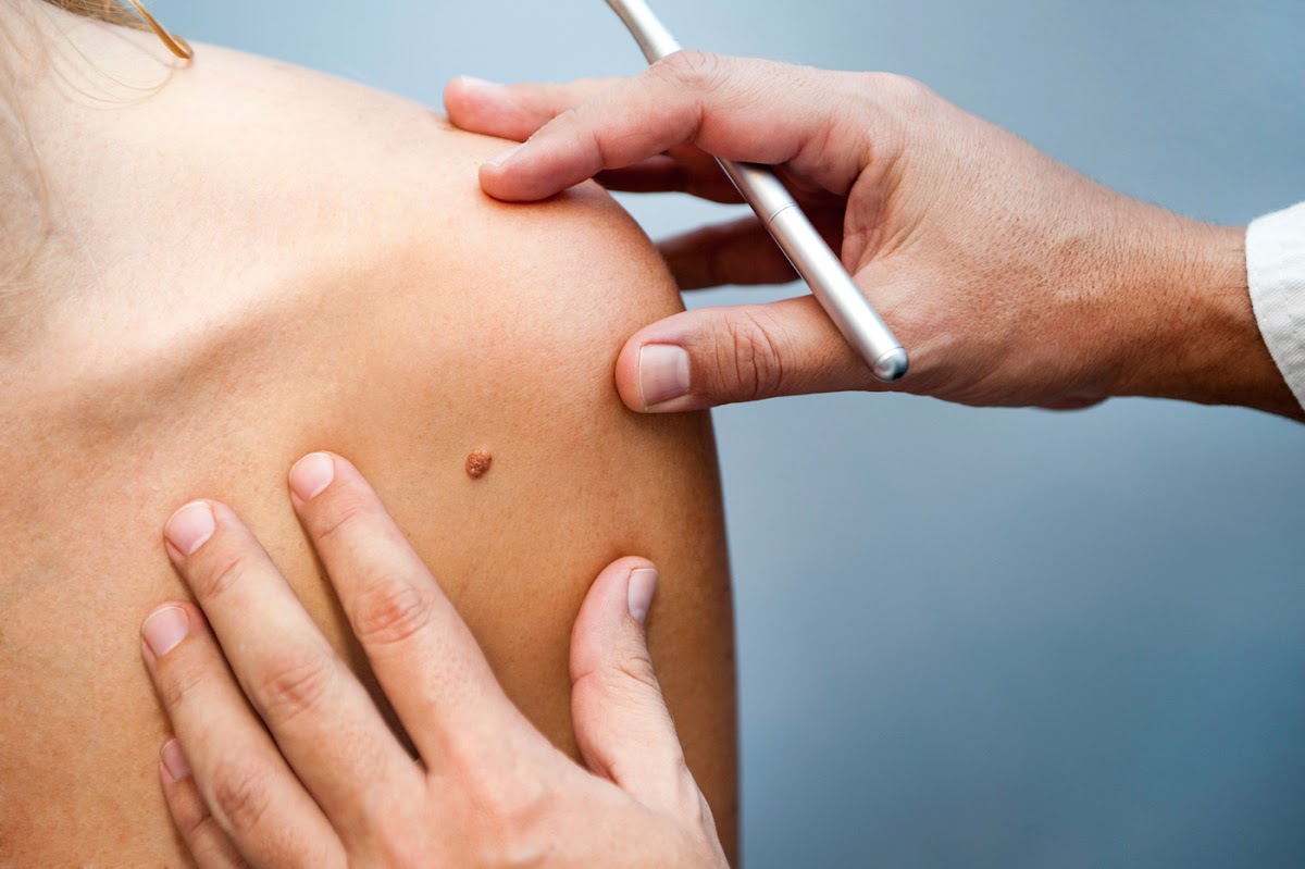 Skin Center Manhattan β laser tattoo removal clinic in New York
