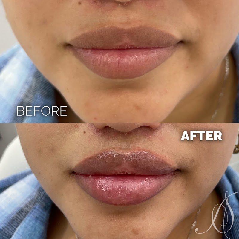 Aesthetic Skin Chicago — laser tattoo removal clinic in Chicago