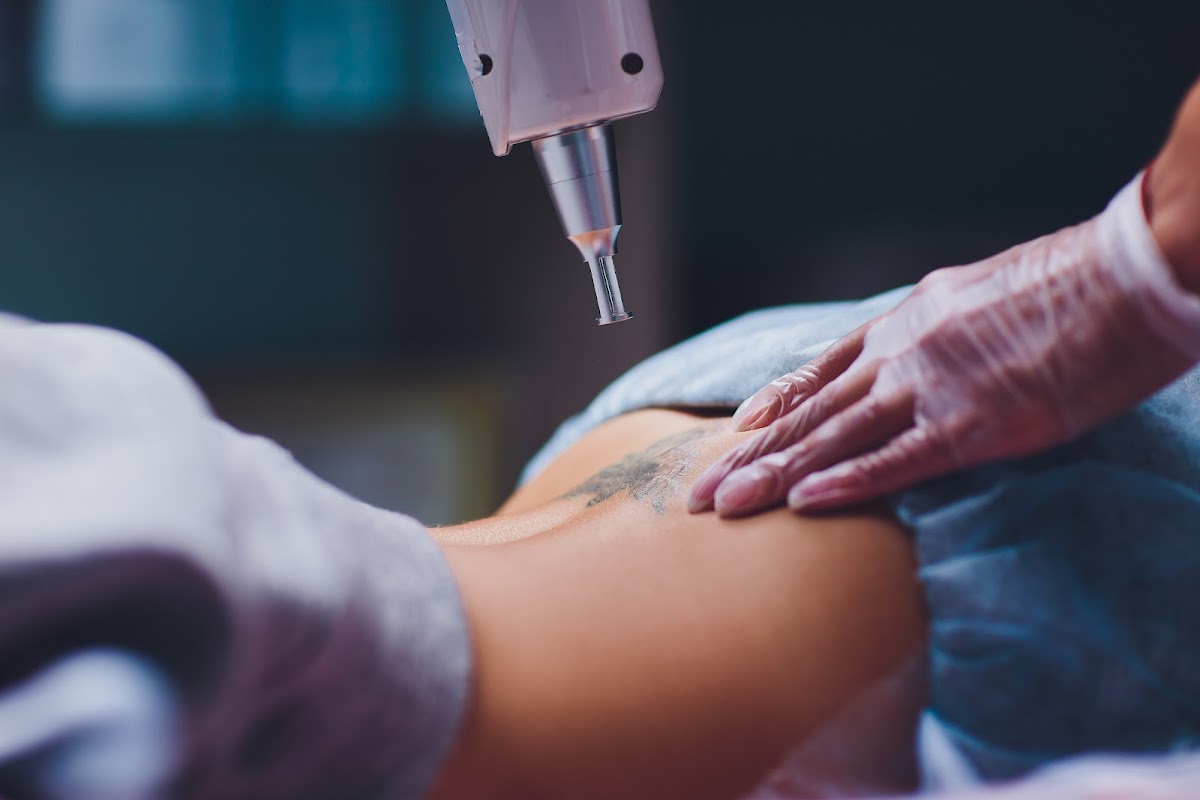 LaserAll (Denver) — laser tattoo removal clinic in Denver