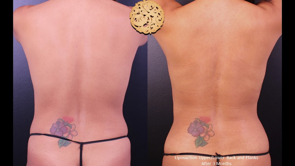 Nazarian Plastic Surgery - Dr. Sheila Nazarian — laser tattoo removal clinic in Beverly Hills