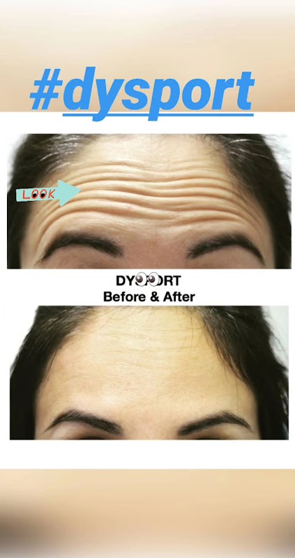 SoCal Body Institute — laser tattoo removal clinic in Chino