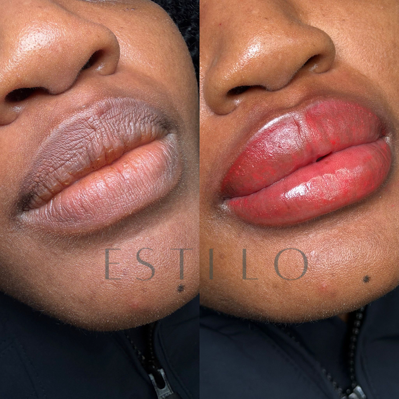 ESTILO Microblading Salon — laser tattoo removal clinic in Chicago