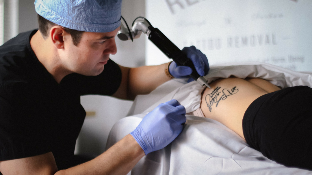 Renewal Tattoo Removal — laser tattoo removal clinic in Raleigh