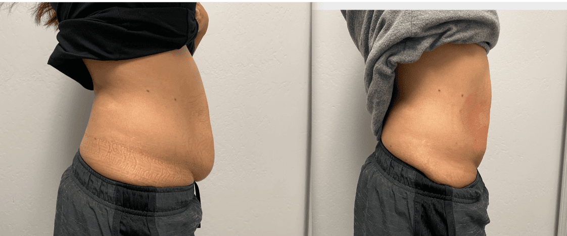 Spa' Mazing Beauty and Wellness — laser tattoo removal clinic in Scottsdale