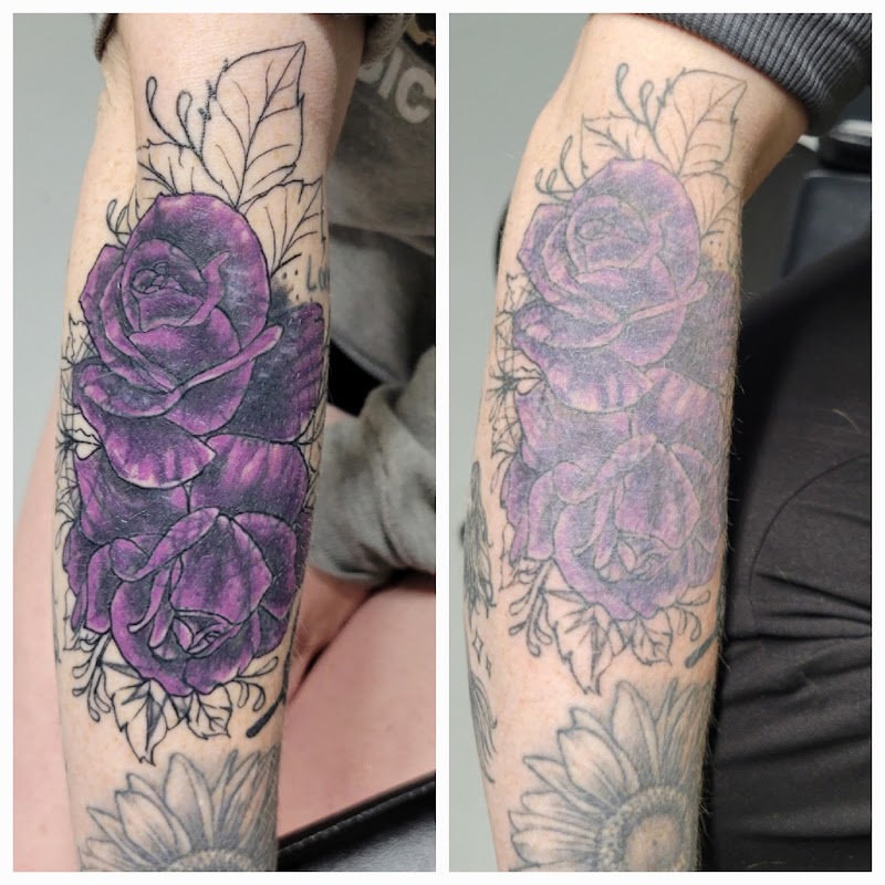 Black Out Tattoo Removal — laser tattoo removal clinic in St Paul