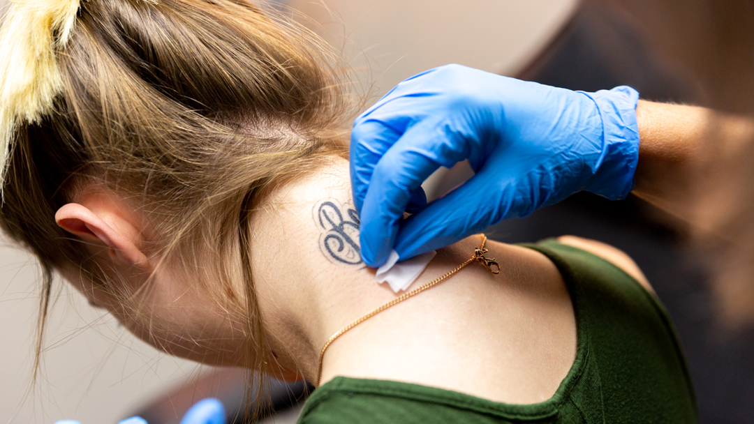 LIGHTEN UP Laser Clinic of NE Houston β laser tattoo removal clinic in Kingwood
