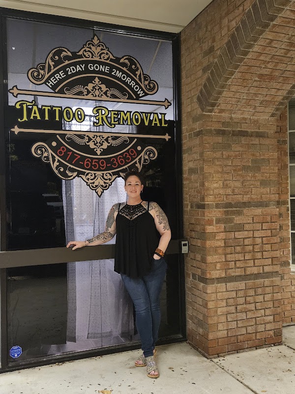 Here 2Day Gone 2Morrow Tattoo Removal β laser tattoo removal clinic in Burleson