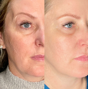 The Aesthetic Edit ATX — laser tattoo removal clinic in Cedar Park
